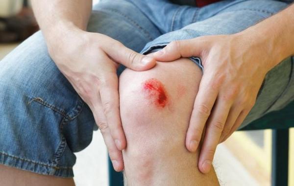 9 نشانه عفونت و آلودگی زخم که هرگز نباید از آن چشم پوشی کرد